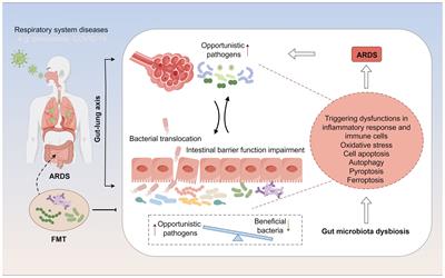 Gut microbiota and its metabolic products in acute respiratory distress syndrome